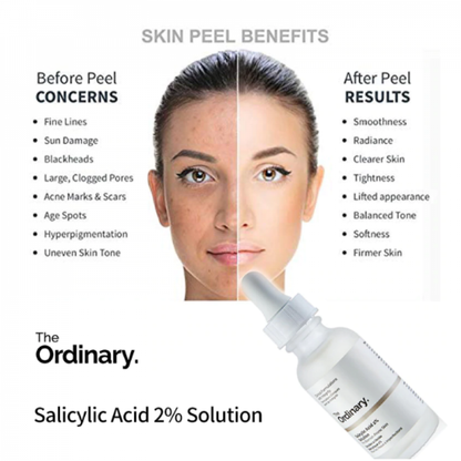 Buy 1Get 1Free Ordinary Niacinamide 10%+Zinc 1% 30ml (Pack 2)